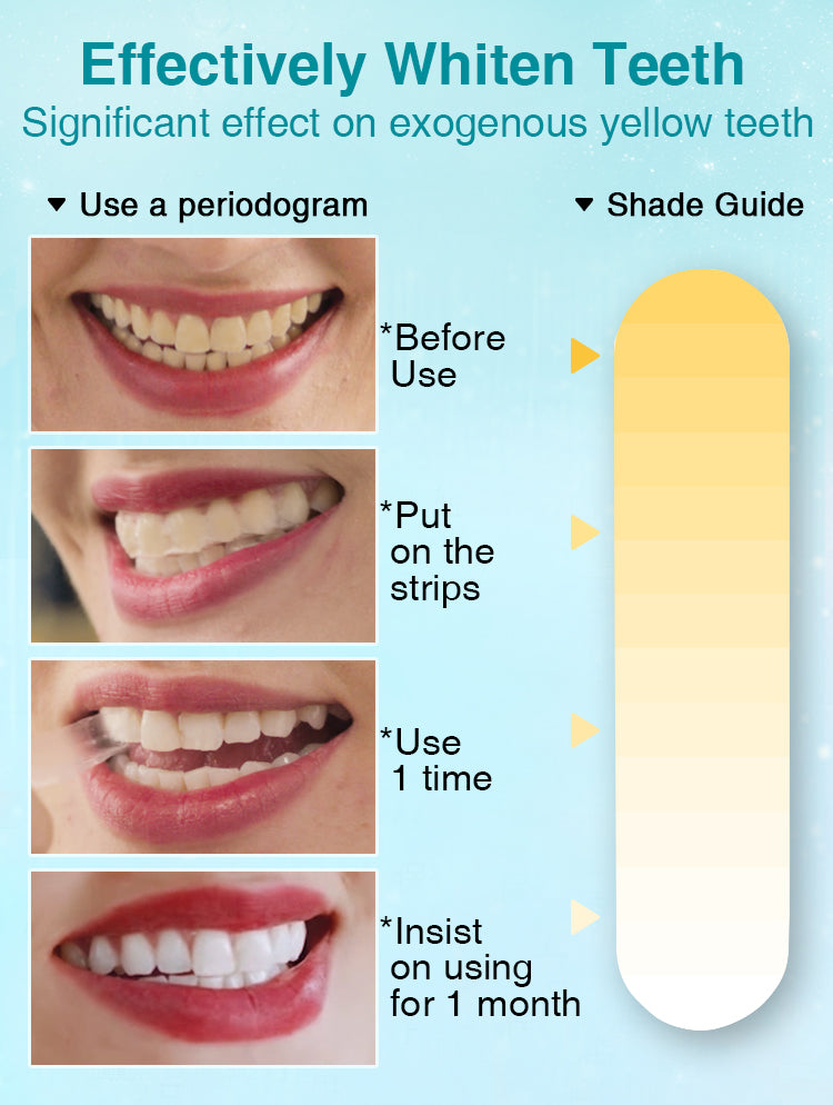 7-Day Whitening Strips (14 Strips)